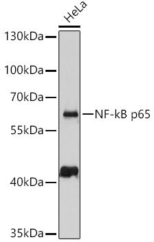NFkB p65 antibody