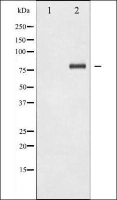 NFkB p65 (Lys310) antibody