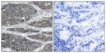 NFKB1 (Ab-932) Antibody