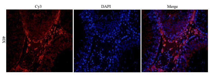 NFKB1 Rabbit Polyclonal Antibody