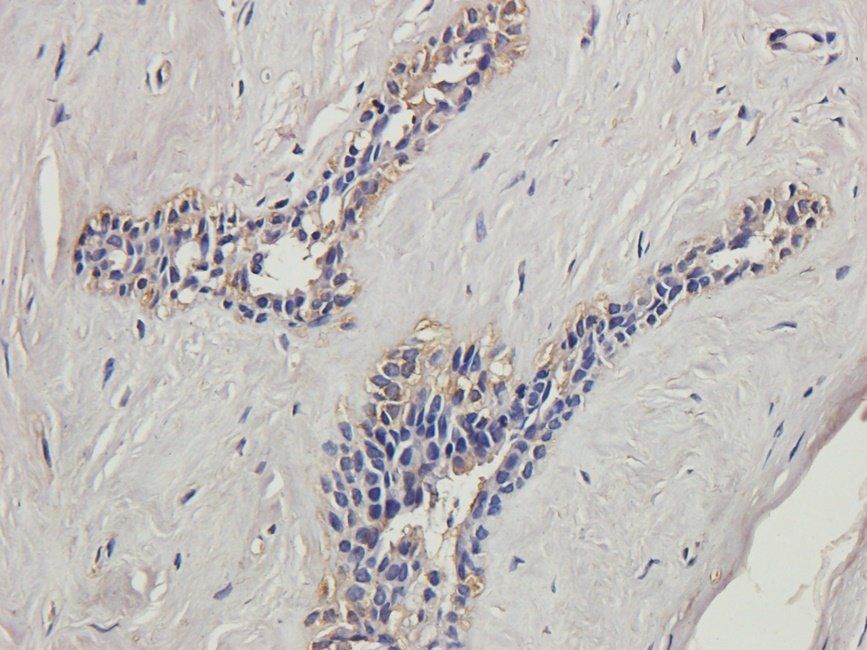 NFKB1 antibody