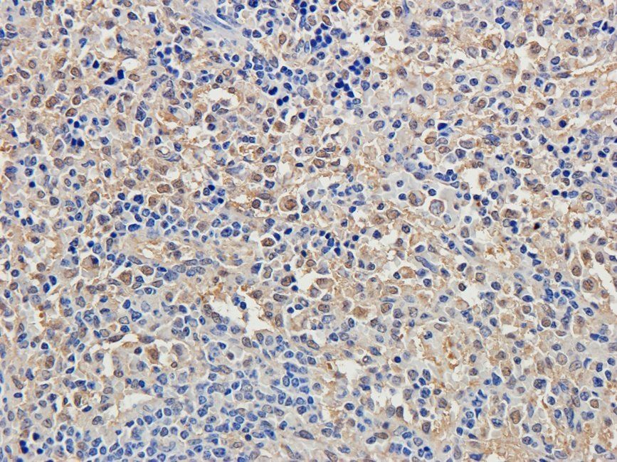NFKB1 Rabbit Polyclonal Antibody