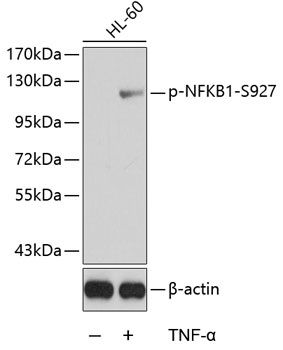 NFKB1 (Phospho-S927) antibody