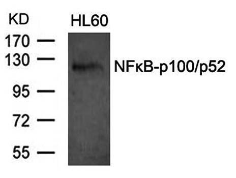 NFκB-p100/p52 (Ab-870) Antibody