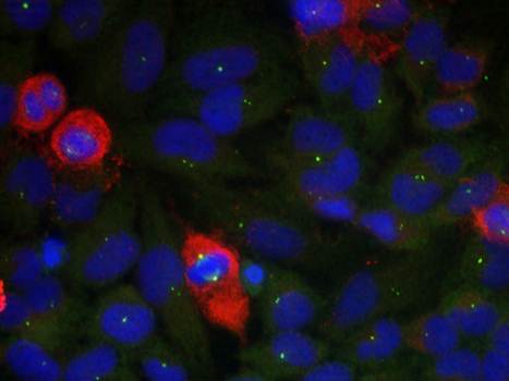 NFκB-p65(Phospho-Thr435) Antibody