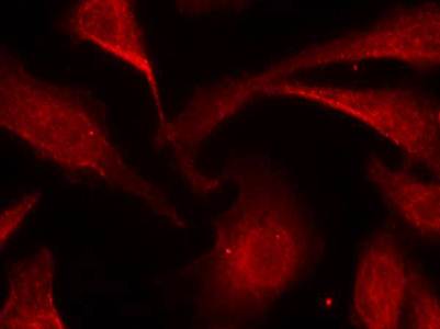 NFκB-p65 (Phospho-Ser529) Antibody