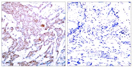 NFκB-p65 (Phospho-Ser536) Antibody