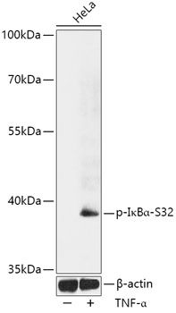 NFKBIA (Phospho-S32) antibody