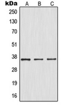 NFKBIA (phospho-S32/S36) antibody