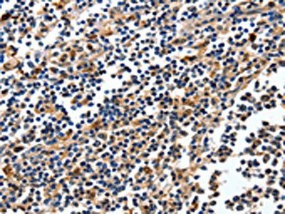 NFKBID antibody