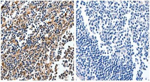 NFKBID Antibody