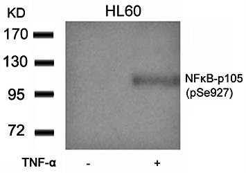 NFκB-p105(Phospho-Ser927) Antibody