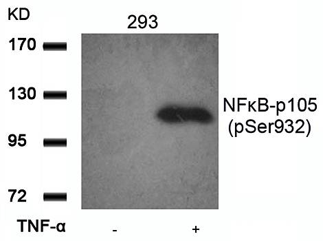 NFκB-p105 (Phospho-Ser932) Antibody