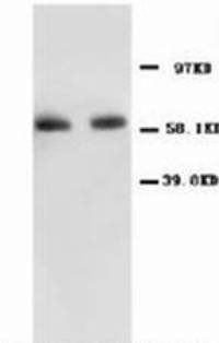 Anti-NF-kB p65/RELA Antibody