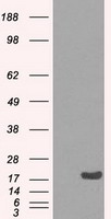 NG2 (CSPG4) antibody