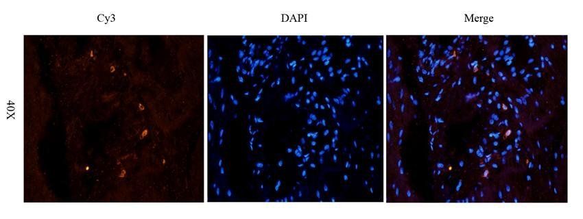 NG2 antibody