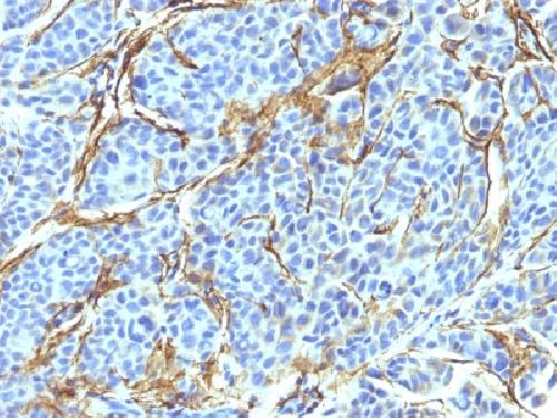 NGF-Receptor (p75) / CD271 (Soft Tissue Tumor Marker) Antibody