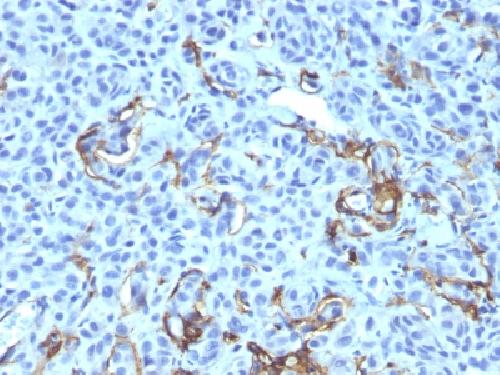 NGF-Receptor (p75) / CD271 (Soft Tissue Tumor Marker) Antibody