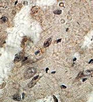NGFR Rabbit Polyclonal Antibody