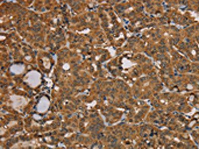 NGFRAP1 Antibody