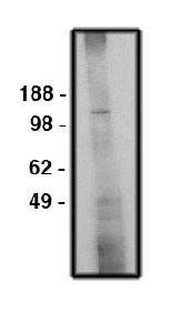 MRSA antibody