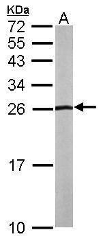 NHERF2 Rabbit Polyclonal Antibody