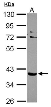 NHERF-2 antibody