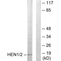 NHLH1 antibody