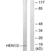 NHLH1/NHLH2 Antibody
