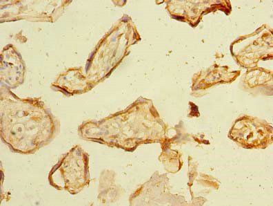 NHLRC2 Antibody