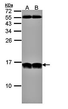 NHP2-like protein 1 antibody