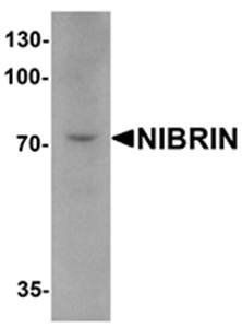 NIBRIN Antibody