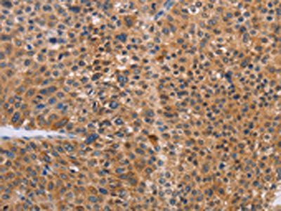 NIF3L1 Antibody