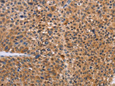 NIF3L1 antibody