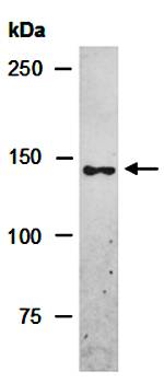 NIK antibody