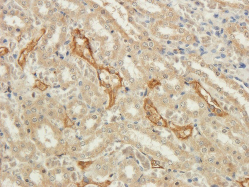 NINJ1 antibody