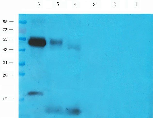 NINJ1 Rabbit Polyclonal Antibody