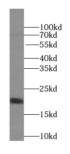 NINJ2 antibody