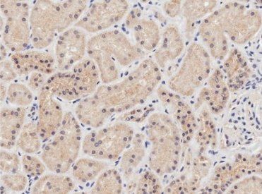 Goat anti-NIPBL (aa889-902) Antibody