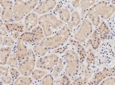 NIPBL antibody