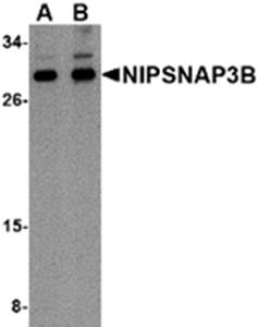 NIPSNAP3B Antibody