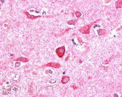 Goat anti-NIR1 / PITPNM3 Antibody