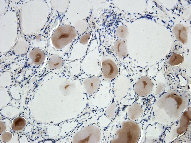 NIS antibody