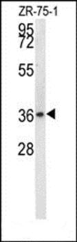 NIT1 antibody