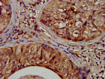 NIT1 Antibody