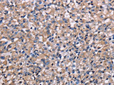 NIT1 Antibody