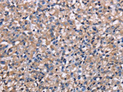 NIT1 antibody