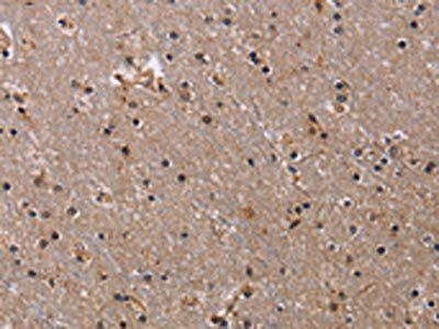 NIT1 Antibody
