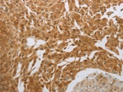NIT2 Antibody