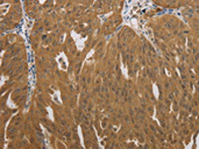 NIT2 Antibody